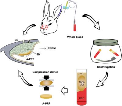 Histological and Histomorphometric Evaluation of Applying a Bioactive Advanced Platelet-Rich Fibrin to a Perforated Schneiderian Membrane in a Maxillary Sinus Elevation Model